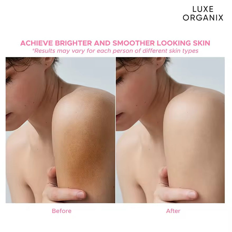 Luxe Organix Niacinamide + Alpha Arbutin Cloud Soap