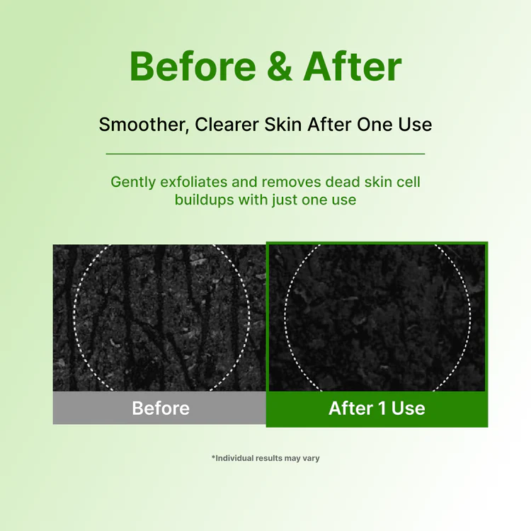 Centellian24 - Madeca Matcha Toning Peeling Gel
