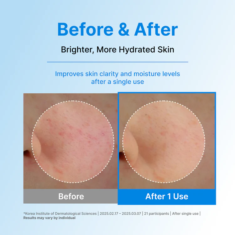 Centellian24 Madeca Lab HYAL Waterfull Glow Gel Mask