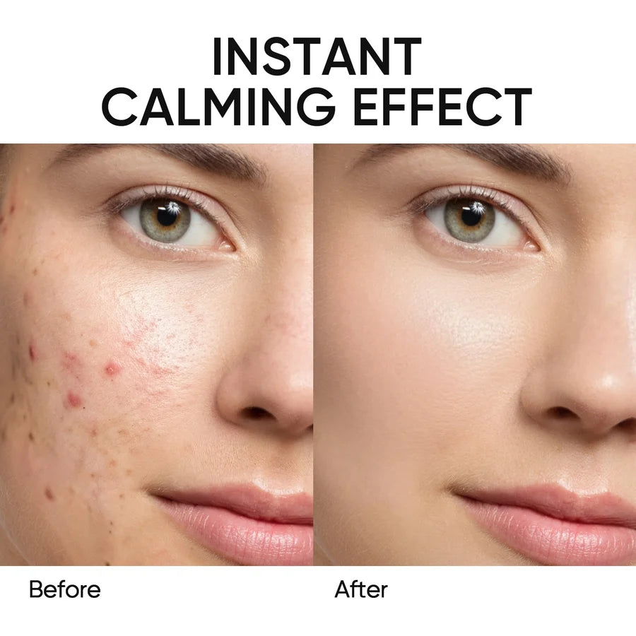 Skintific Mugwort Acne Clay Stick