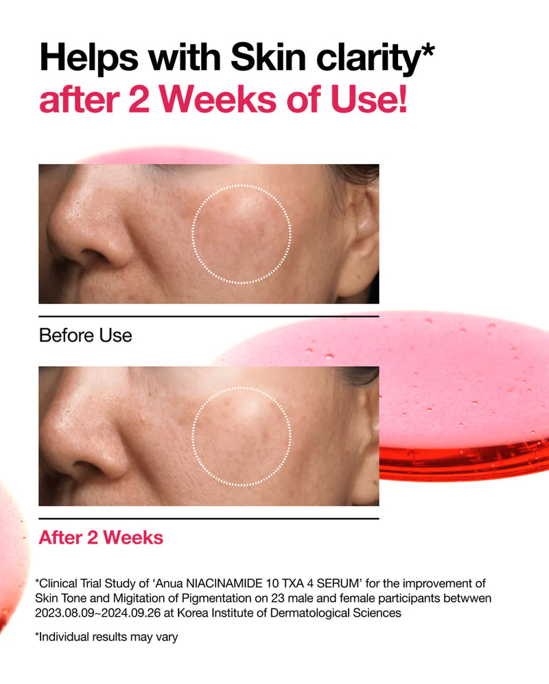 Anua Niacinamide 10% + TXA 4% Dark Spot Correcting Serum