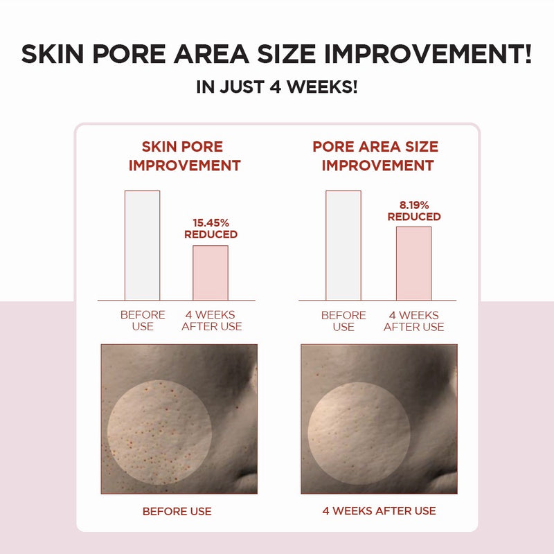 Skin1004 Madagascar Centella Poremizing Clear Toner