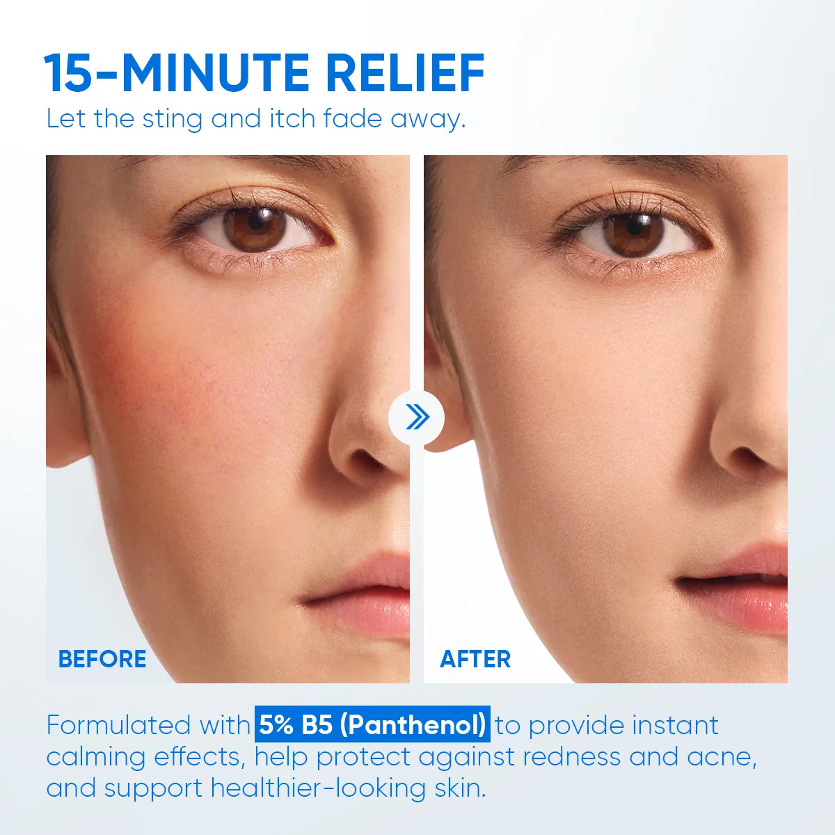 Skintific 5% B5 Ceramide Barrier Relief Moisturizer
