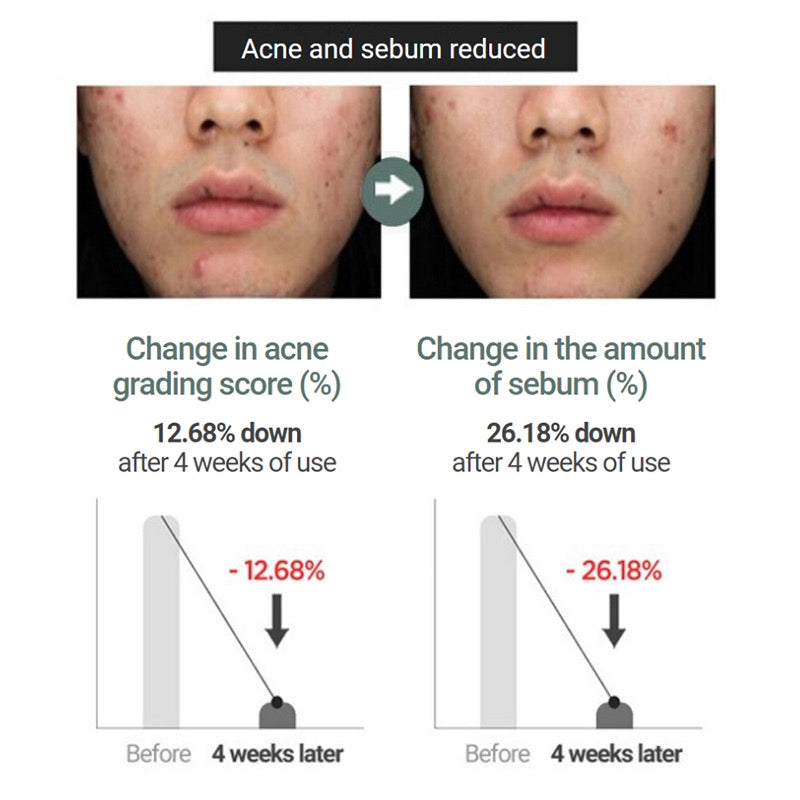 Anua Heartleaf 77% Soothing Toner 250ml