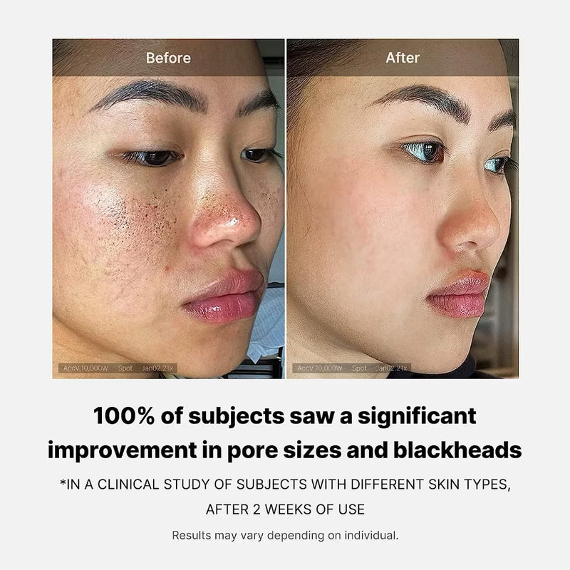 Medicube Zero Pore Pad 2.0