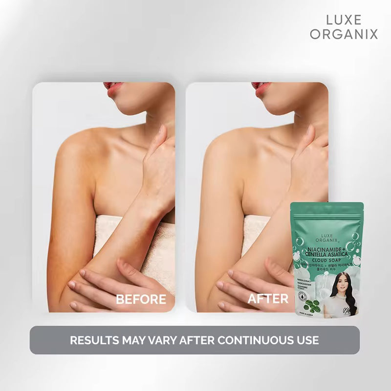 Luxe Organix Niacinamide + Centella Asiatica Cloud Soap