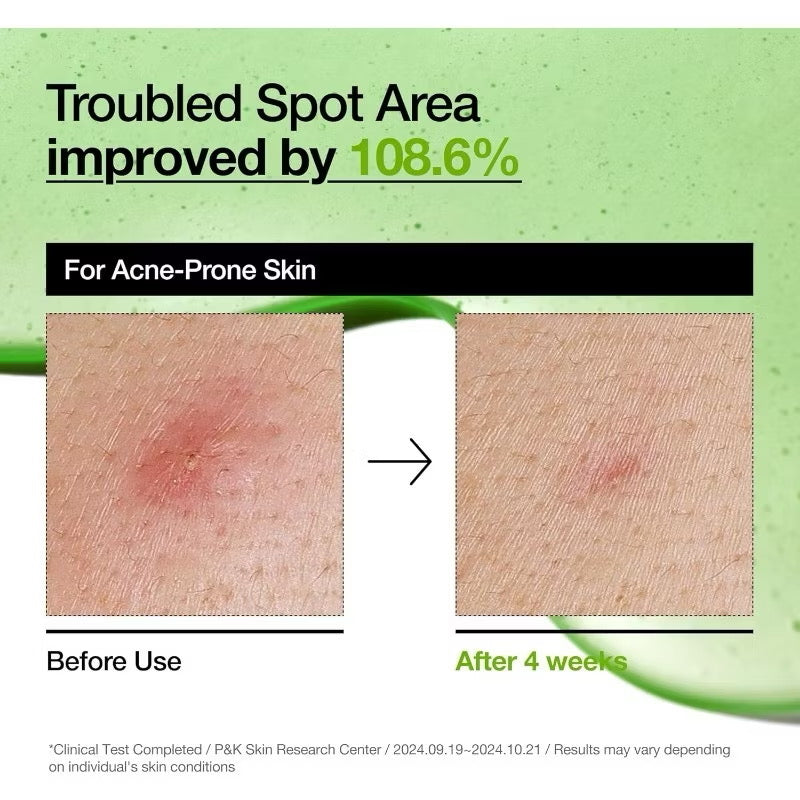 Anua Azelaic Acid 10 Hyaluron Redness Soothing Serum