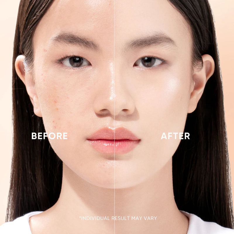 Skintific Gentle Retinol Moisturizer 30g