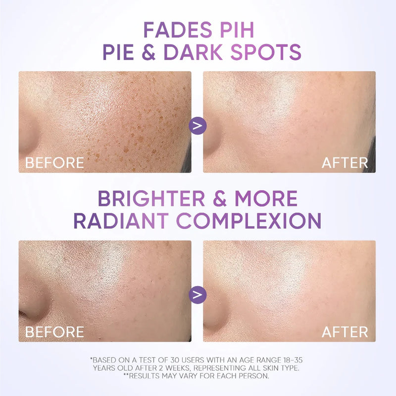 Skintific SymWhite 377 Dark Spot Moisture Gel