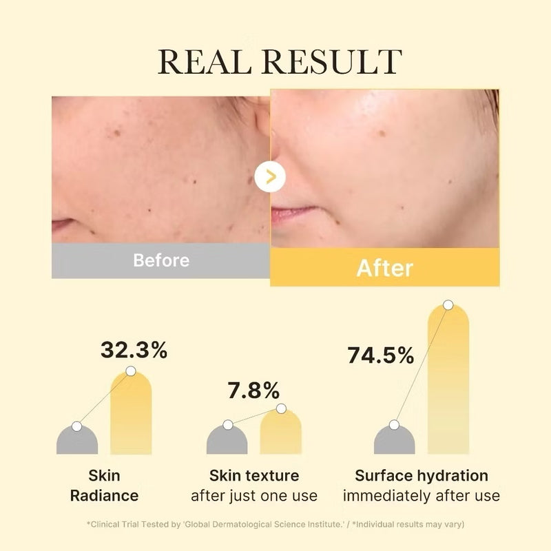 Medicube Kojic Acid Turmeric Brightening Gel Mask Set 4 Sheets