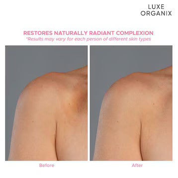 Luxe Organix Niacinamide + Arbutin Whitening Serum Lotion