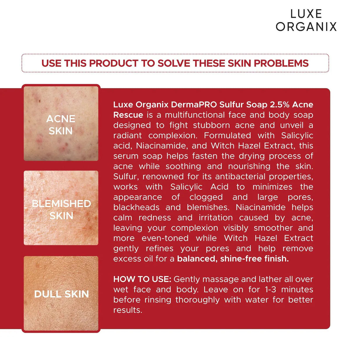 Luxe Organix Derma Pro Sulfur Soap 2.5%