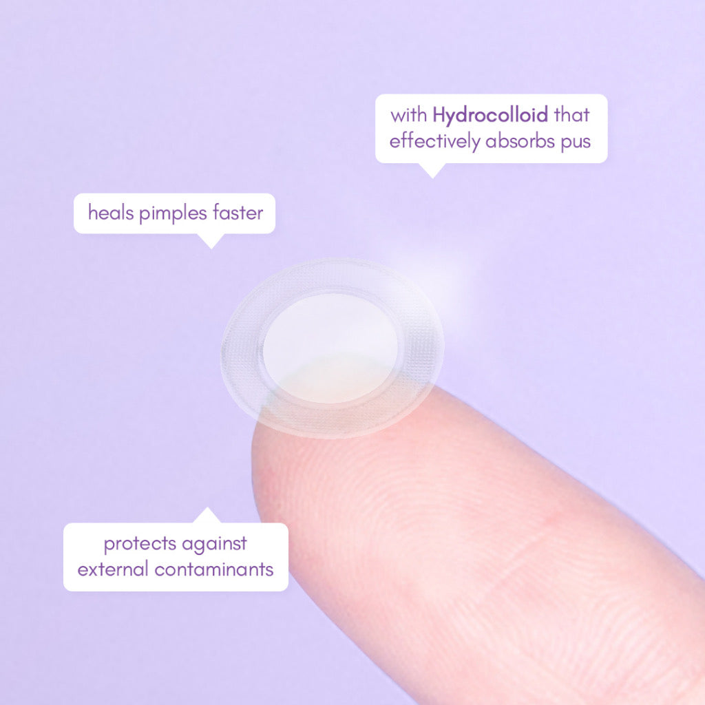 Belo AcnePro Pimple Patch