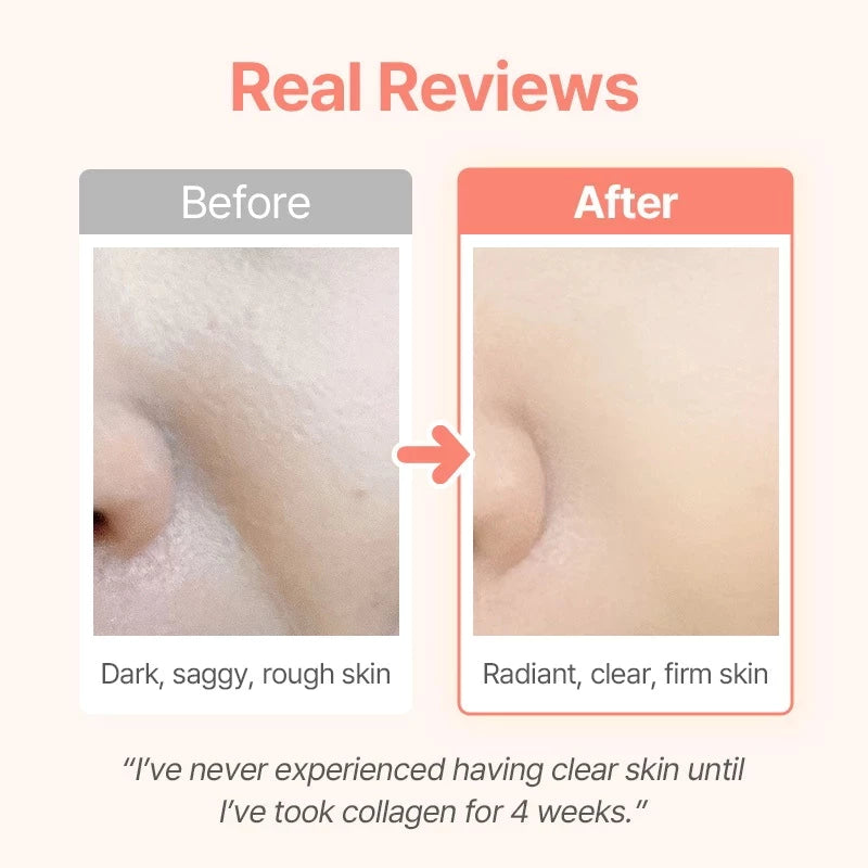 NE:AR Glow Collagen Chews
